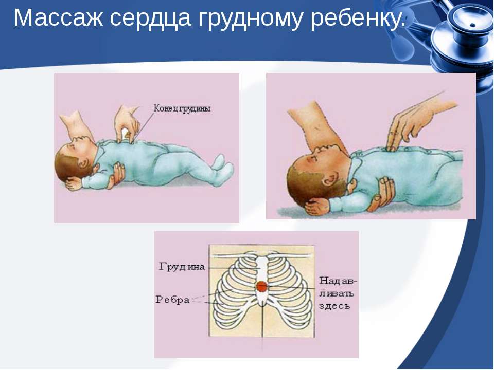 Слр новорожденных презентация