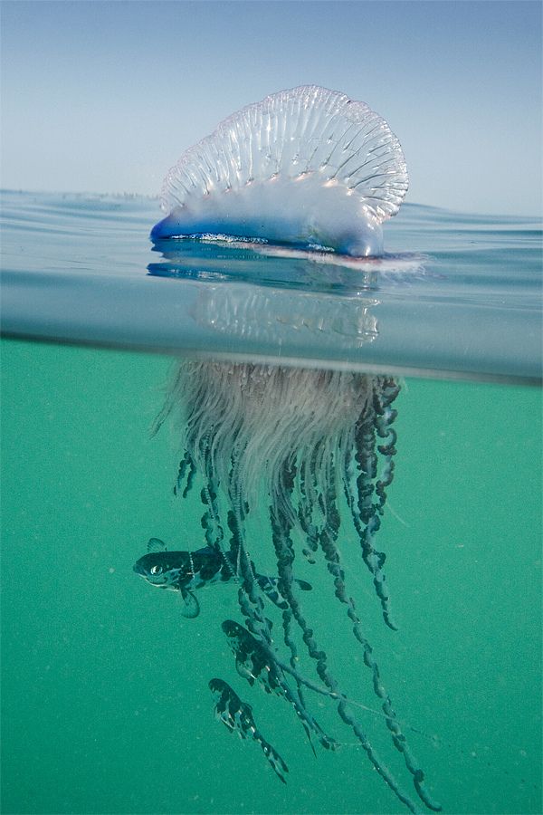 ужалила медуза